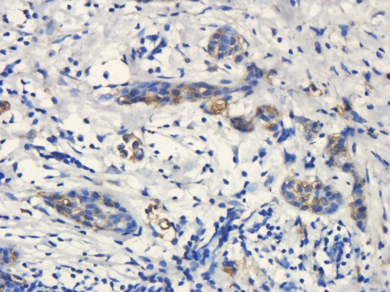 CD133 antibody