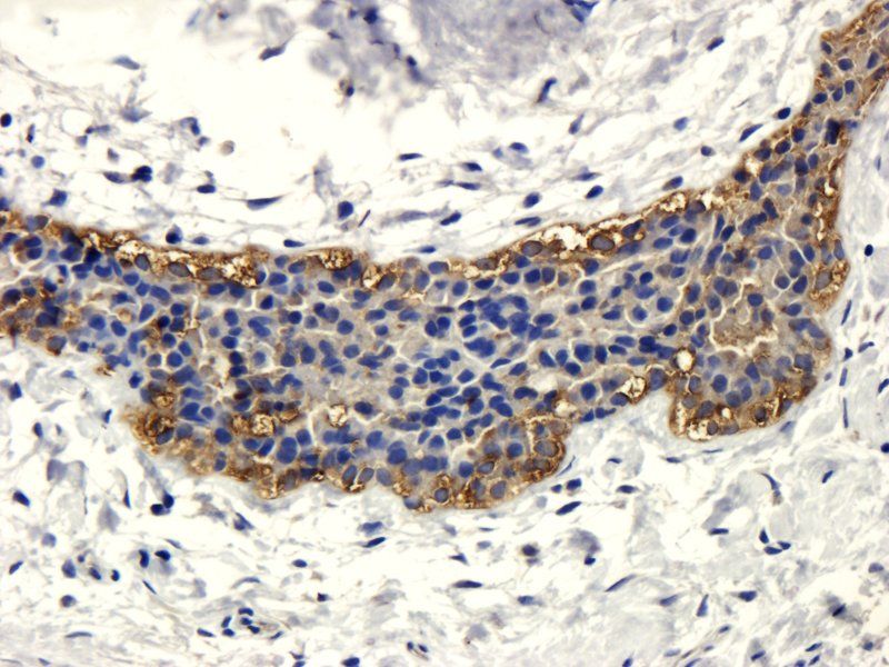 CD133 antibody