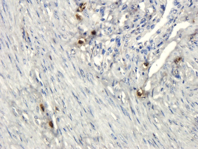 CD133 antibody