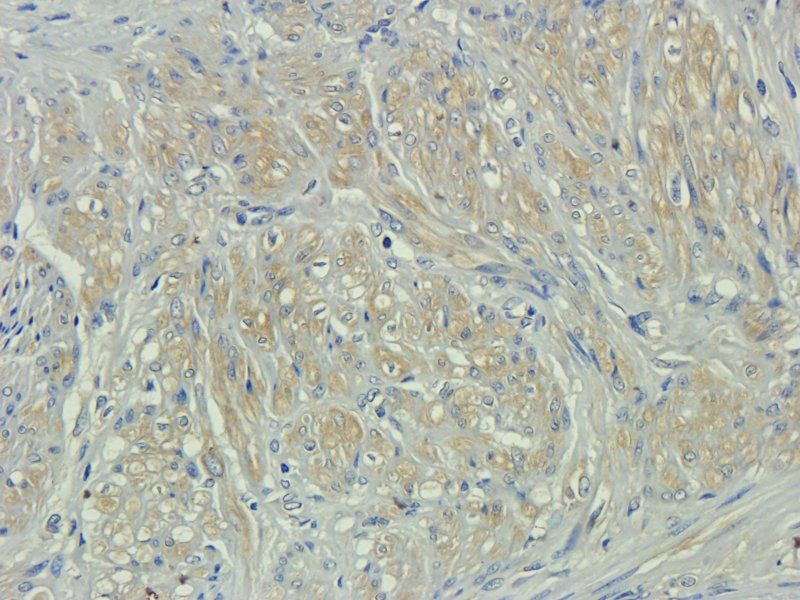 CD133E1 antibody