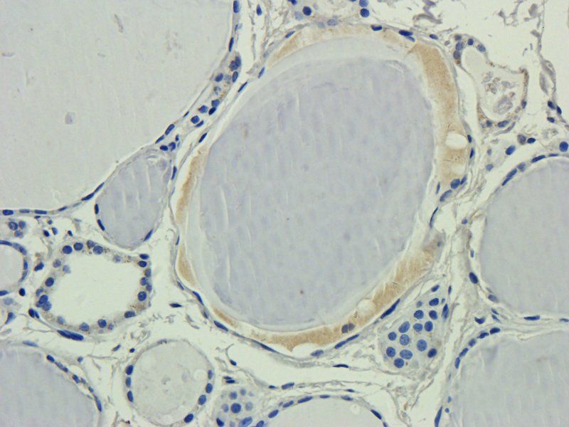 CD133E1 antibody