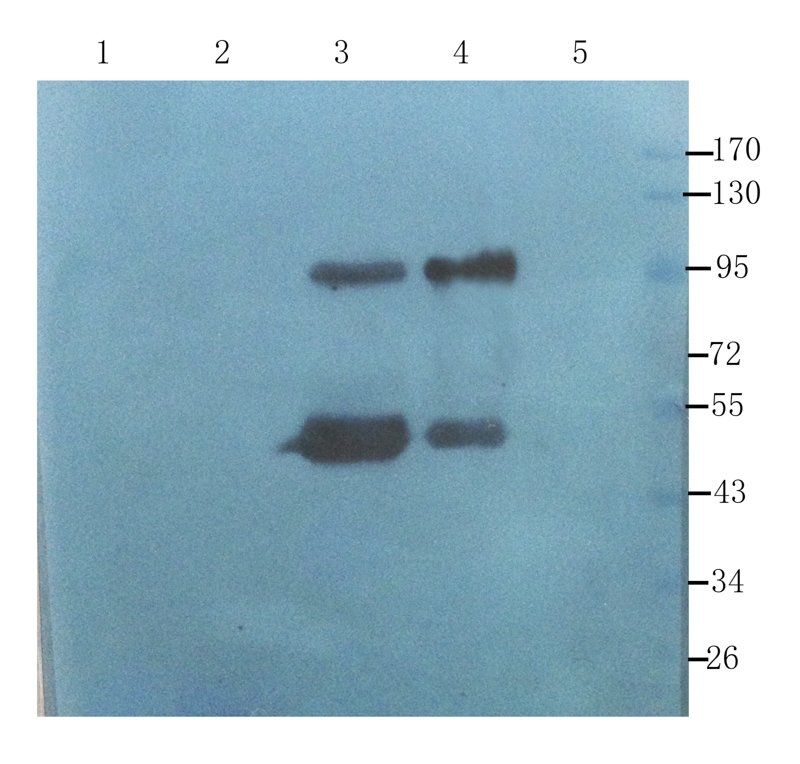 CD133E1 antibody