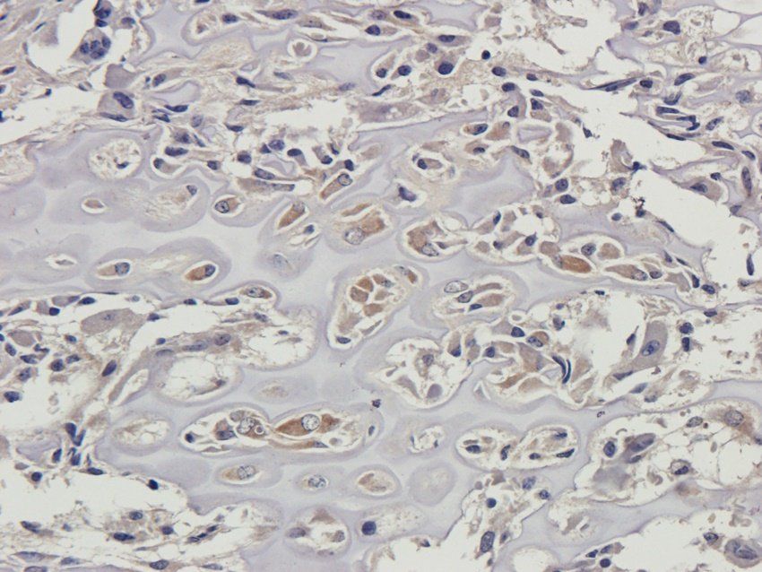 CD137 antibody