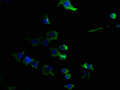 CD14 Monoclonal Antibody