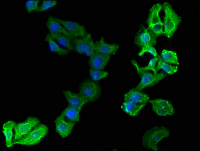CD14 Monoclonal Antibody