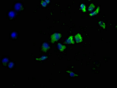 CD14 Monoclonal Antibody
