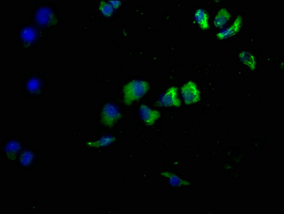 CD14 antibody