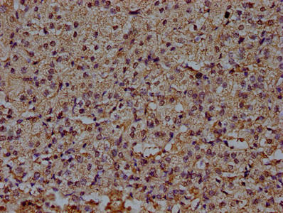 CD14 Monoclonal Antibody