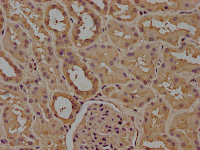 CD14 Monoclonal Antibody