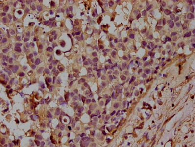 CD14 Monoclonal Antibody