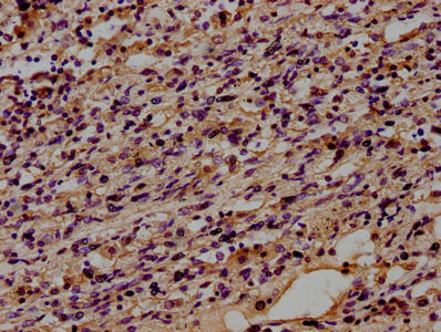 CD14 Monoclonal Antibody