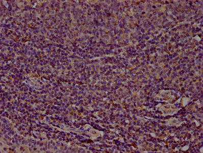 CD14 Monoclonal Antibody