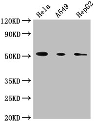 CD14 Monoclonal Antibody