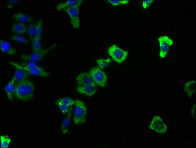 CD14 Monoclonal Antibody