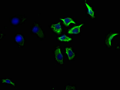 CD14 Monoclonal Antibody