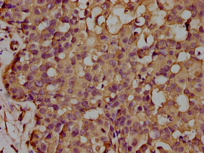CD14 Monoclonal Antibody
