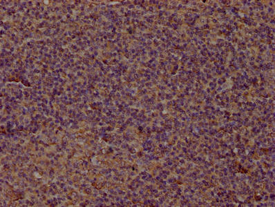 CD14 Monoclonal Antibody