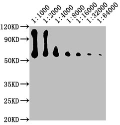 CD14 Monoclonal Antibody