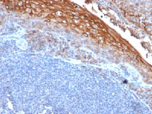 MCAM (Melanoma Cell Adhesion Molecule) / MUC18 / CD146 Antibody