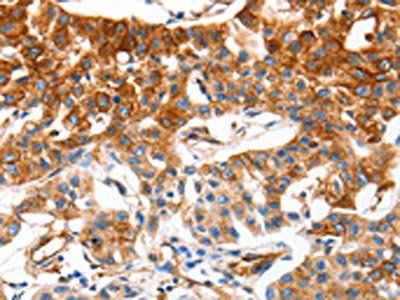 MCAM Antibody