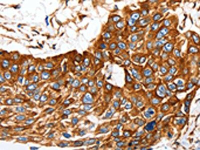 MCAM Antibody