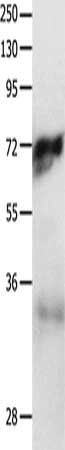 MCAM Antibody