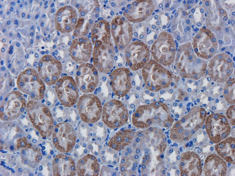 CD146 antibody