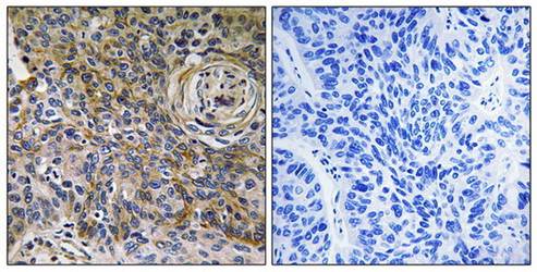 CD147 antibody