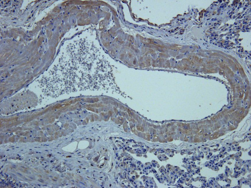 CD14 antibody