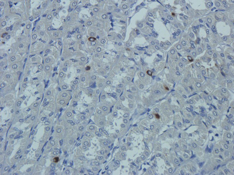 CD14 antibody