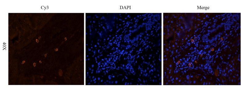 CD14 antibody