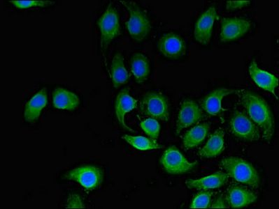 CD151 Antibody