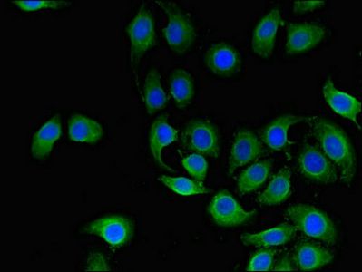 CD151 antibody