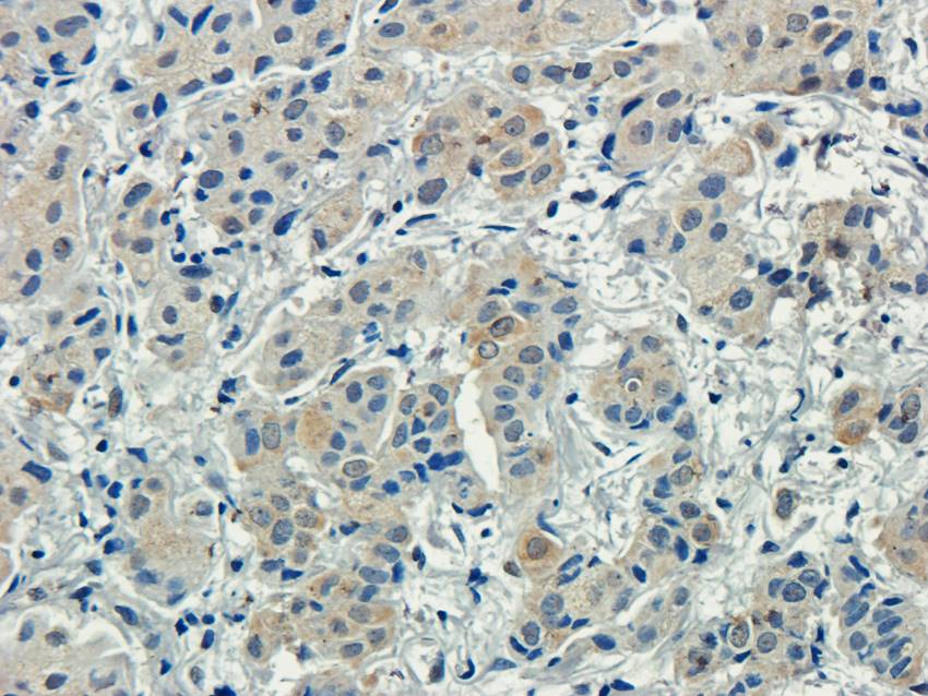 CD155 antibody