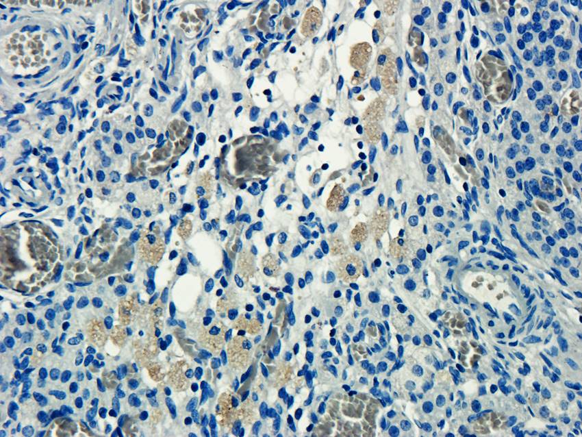 CD155 antibody