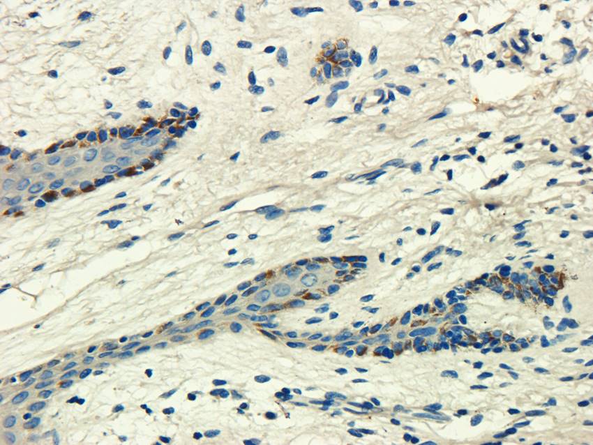 CD155 antibody