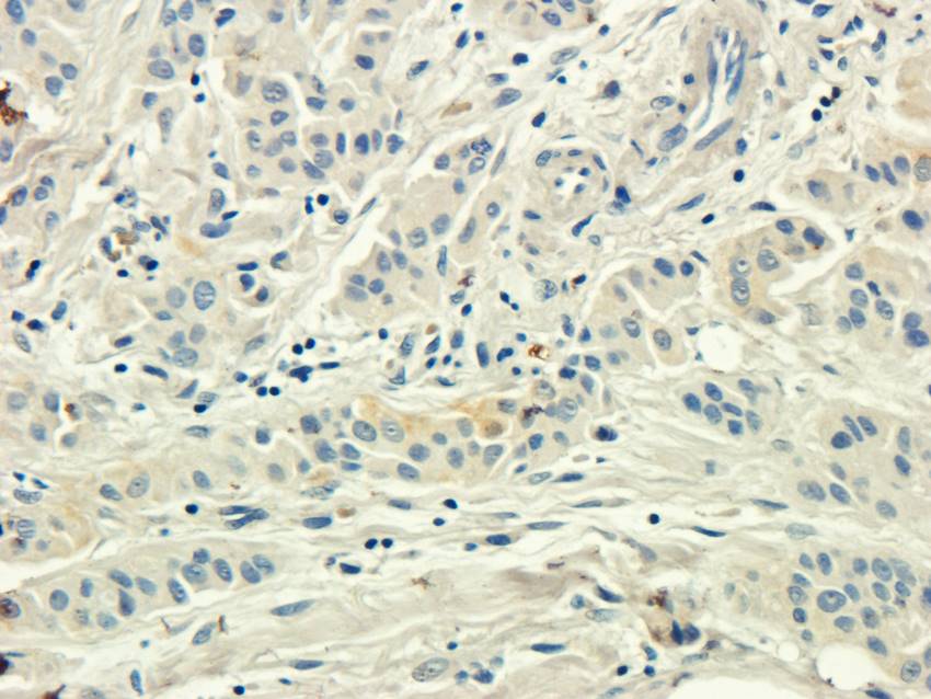 CD155 antibody