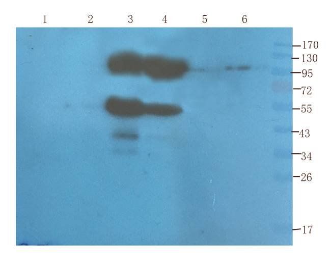 CD155 antibody