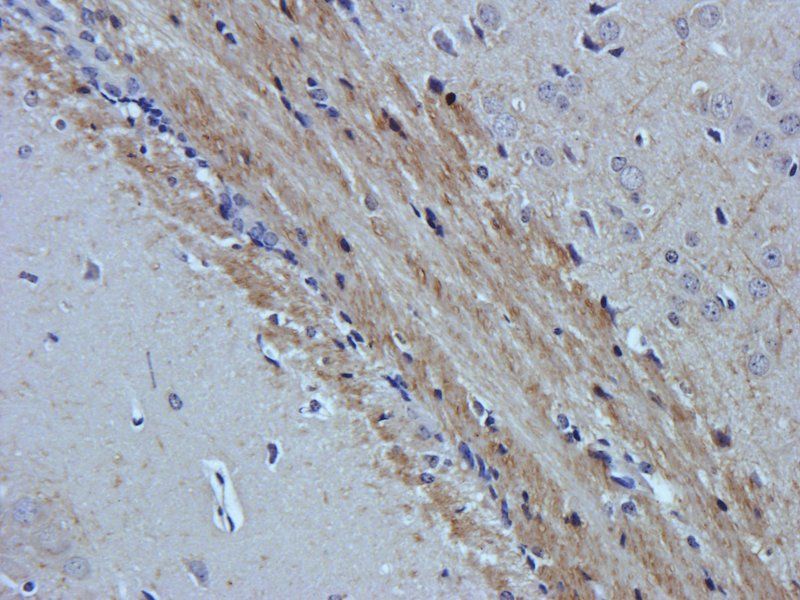 CD15 antibody