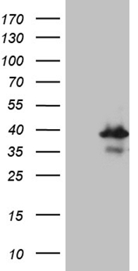 CD160 Antibody