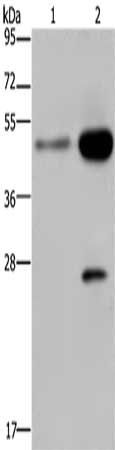 CD160 antibody
