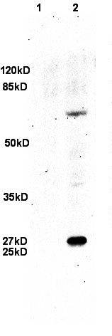 CD160 antibody