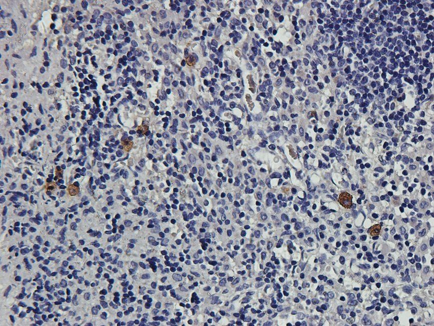 CD163 antibody