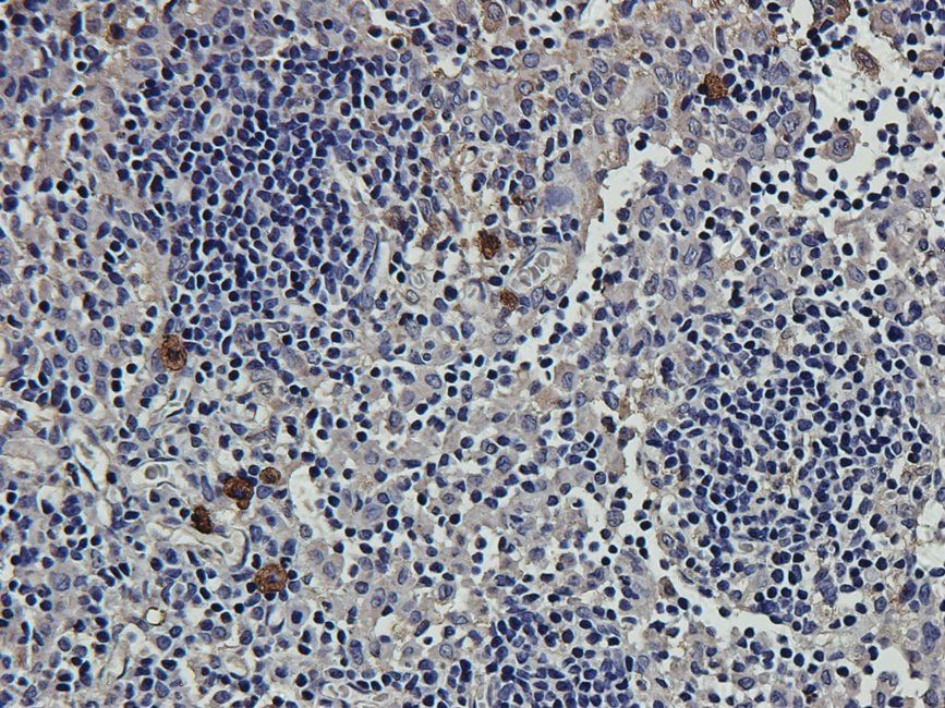 CD163 antibody