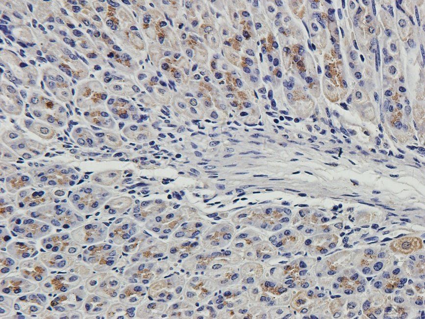 CD163 antibody