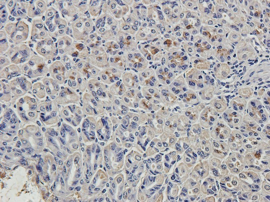 CD163 antibody