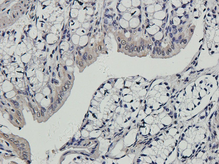 CD163 antibody