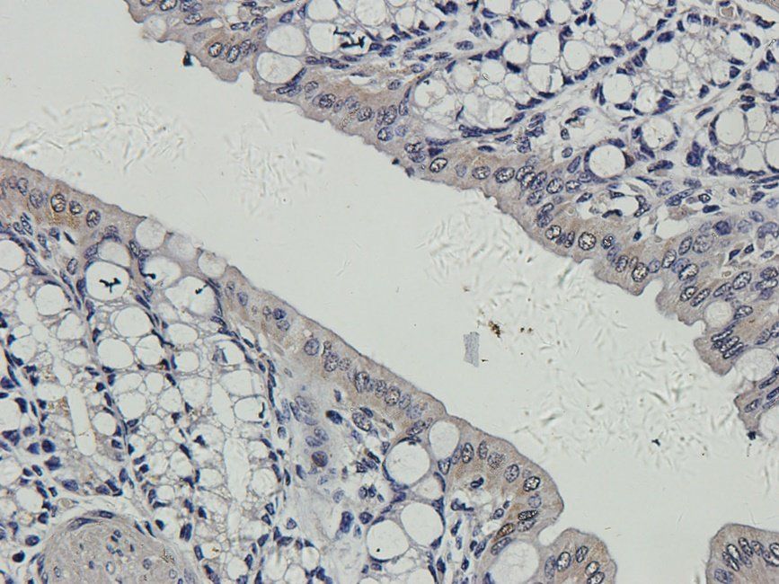 CD163 antibody