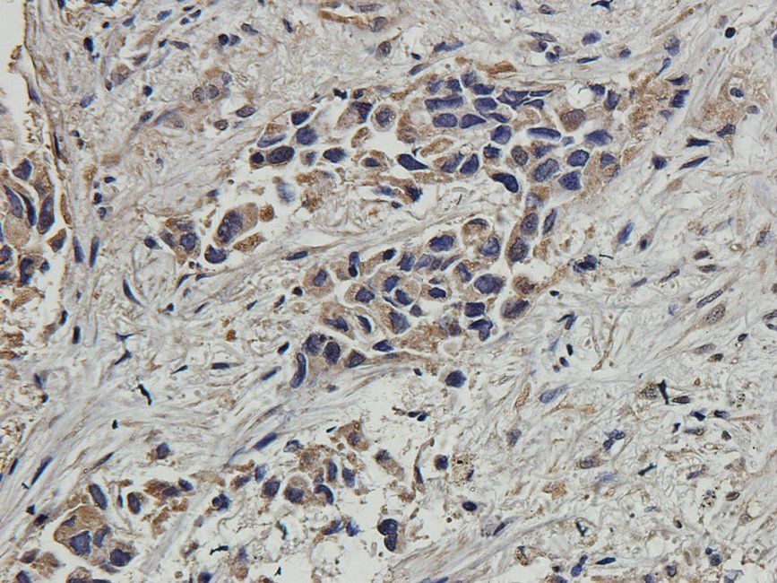 CD163 antibody