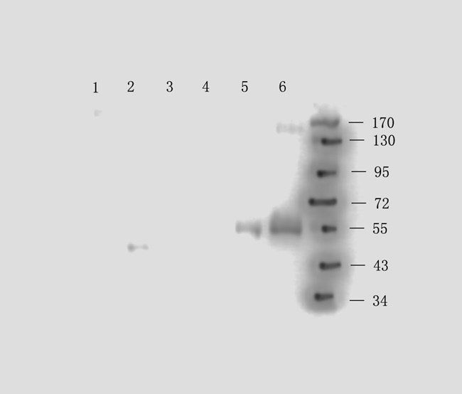 CD163 antibody